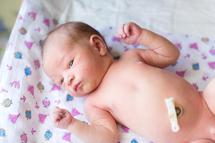 Ciri-Ciri Tali Pusar Bayi Baru Lahir yang Mengalami Infeksi & Cara Mengobatinya